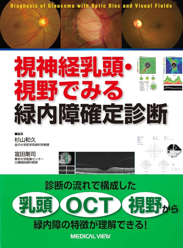 視神経乳頭・視野でみる緑内障確定診断 視神経乳頭・視野でみる緑内障確定診断 | 杉山 和久, 富田 剛司
